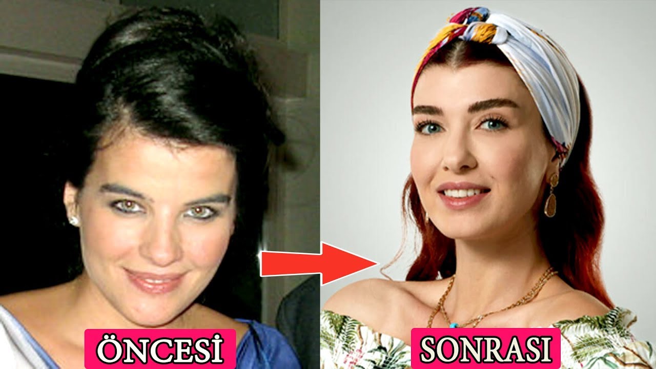 KUZEY YILDIZI Oyuncularının Öncesi ve Sonrası (Yeni Dizi)