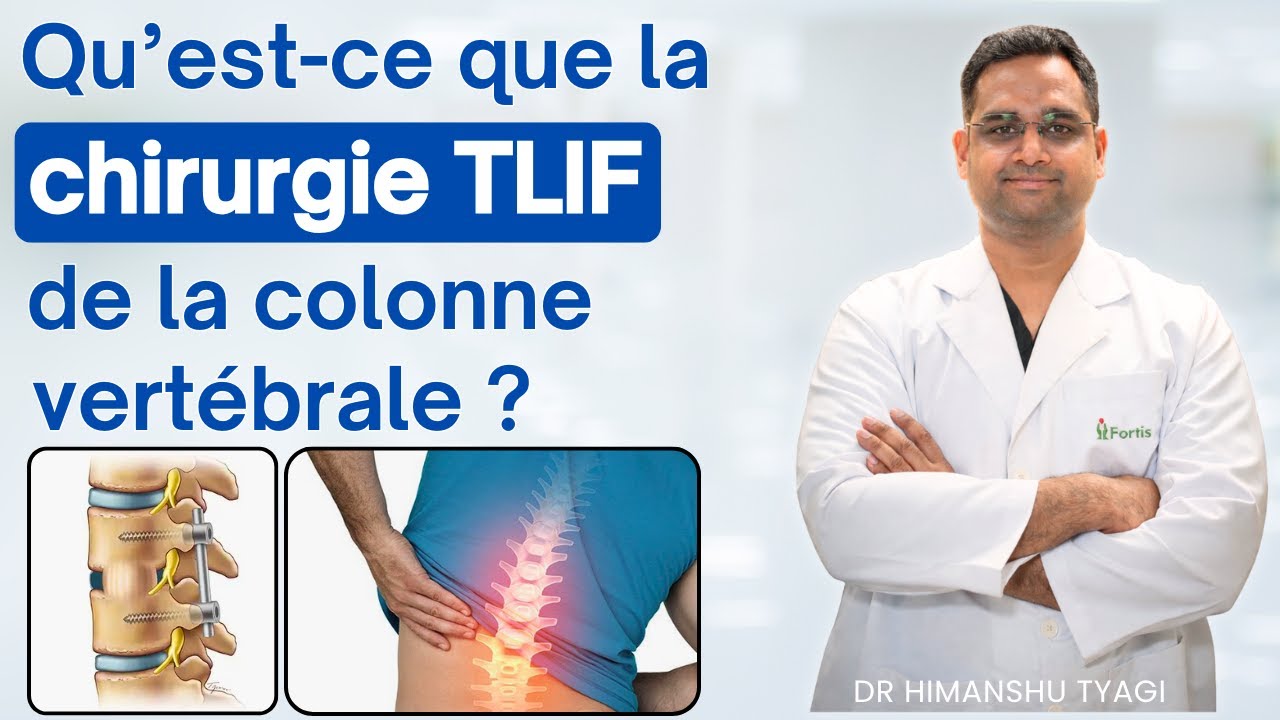 Qu’est-ce que la chirurgie TLIF de la colonne vertébrale ? | What is TLIF surgery in spine?in French