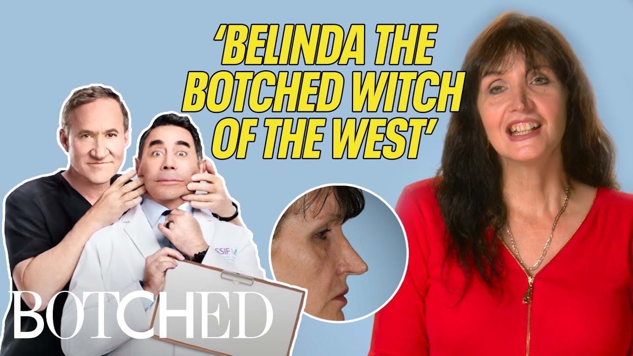 Belinda's Nose Makes Her Look Like The 'Botched Witch of the West' | Botched | E!