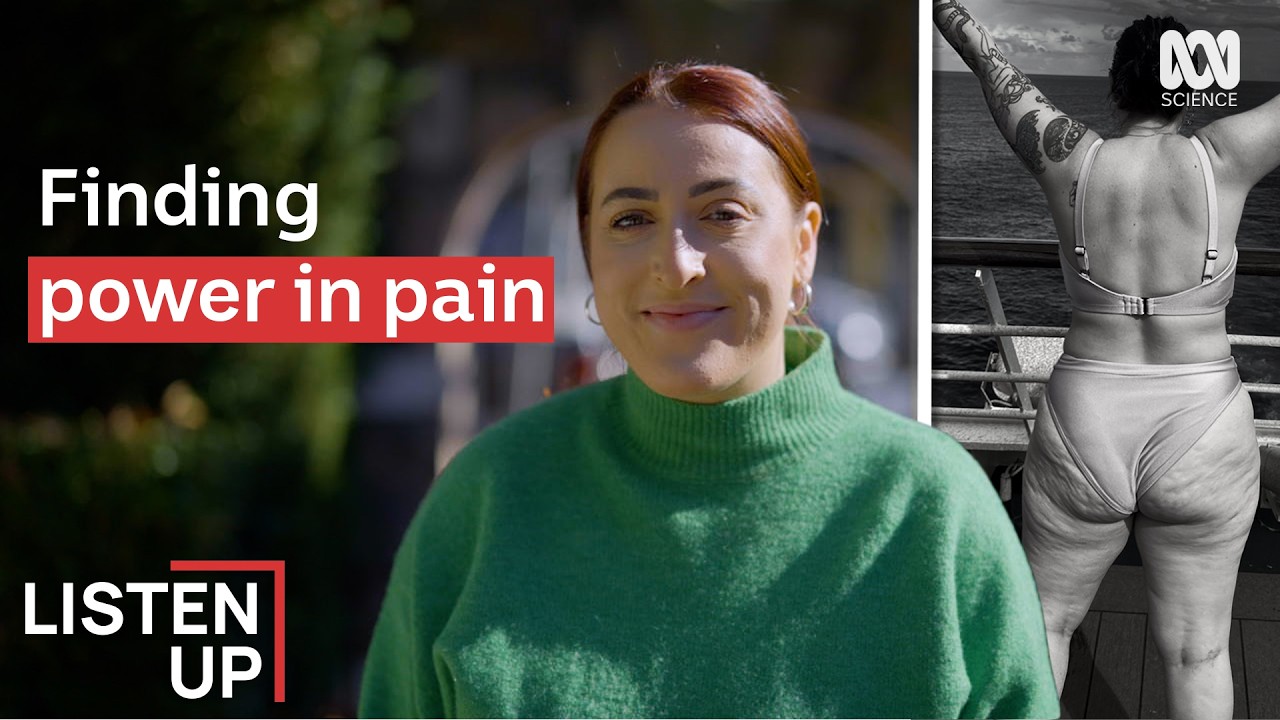 Липедема: когда жир причиняет боль