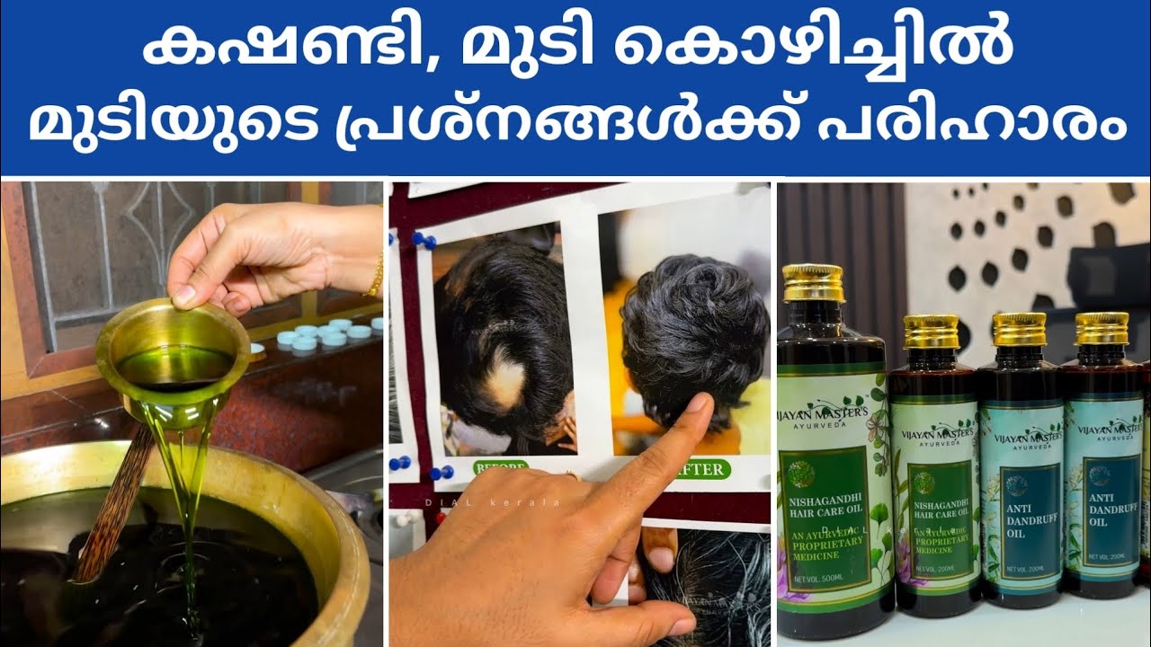 Hair Oil | Ayurveda Hospital