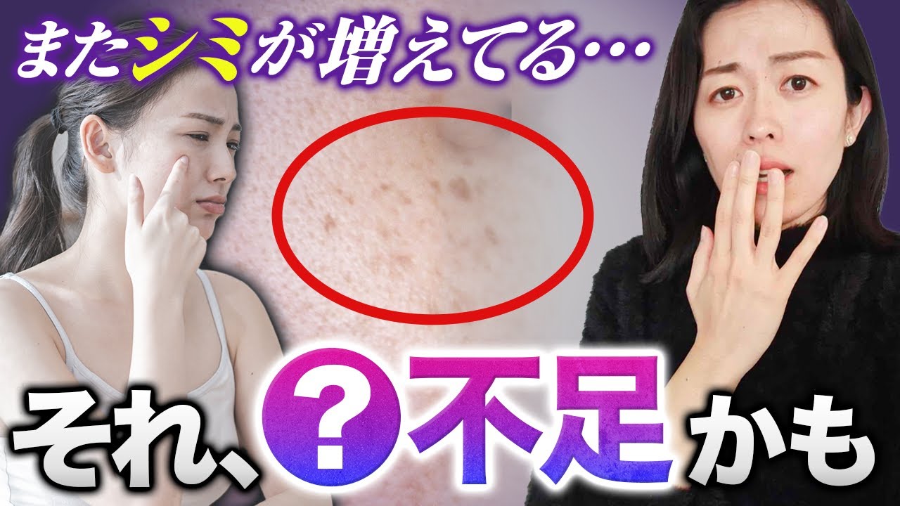 シミができた←○○不足の可能性あり（美肌作りに欠かせない栄養素についても解説）