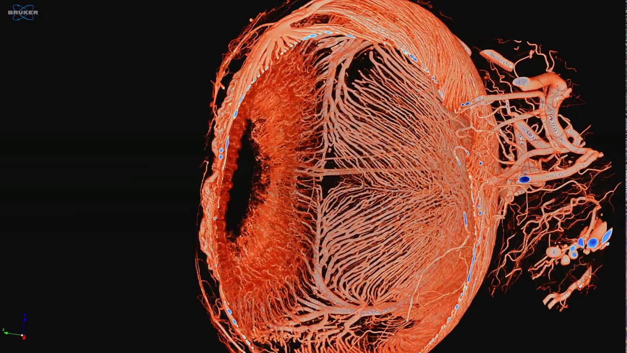 Micro-CT of Eye Vasculature