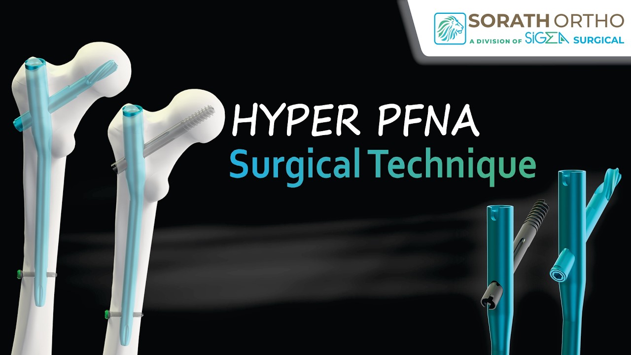 Hyper PFNA Surgical Technique