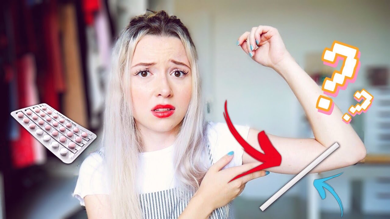 DE L’IMPLANT CONTRACEPTIF À LA PILULE : mon expérience ... | BeYourself