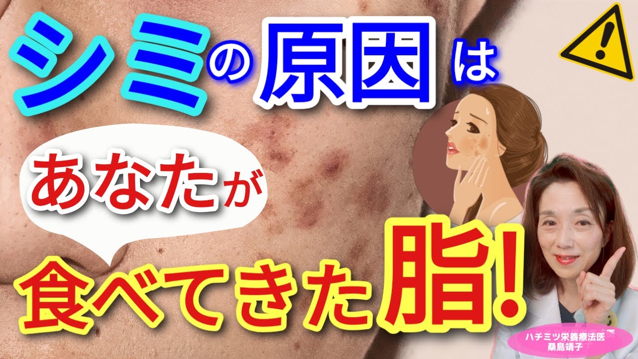 シミの原因は、あなたが食べてきた脂！