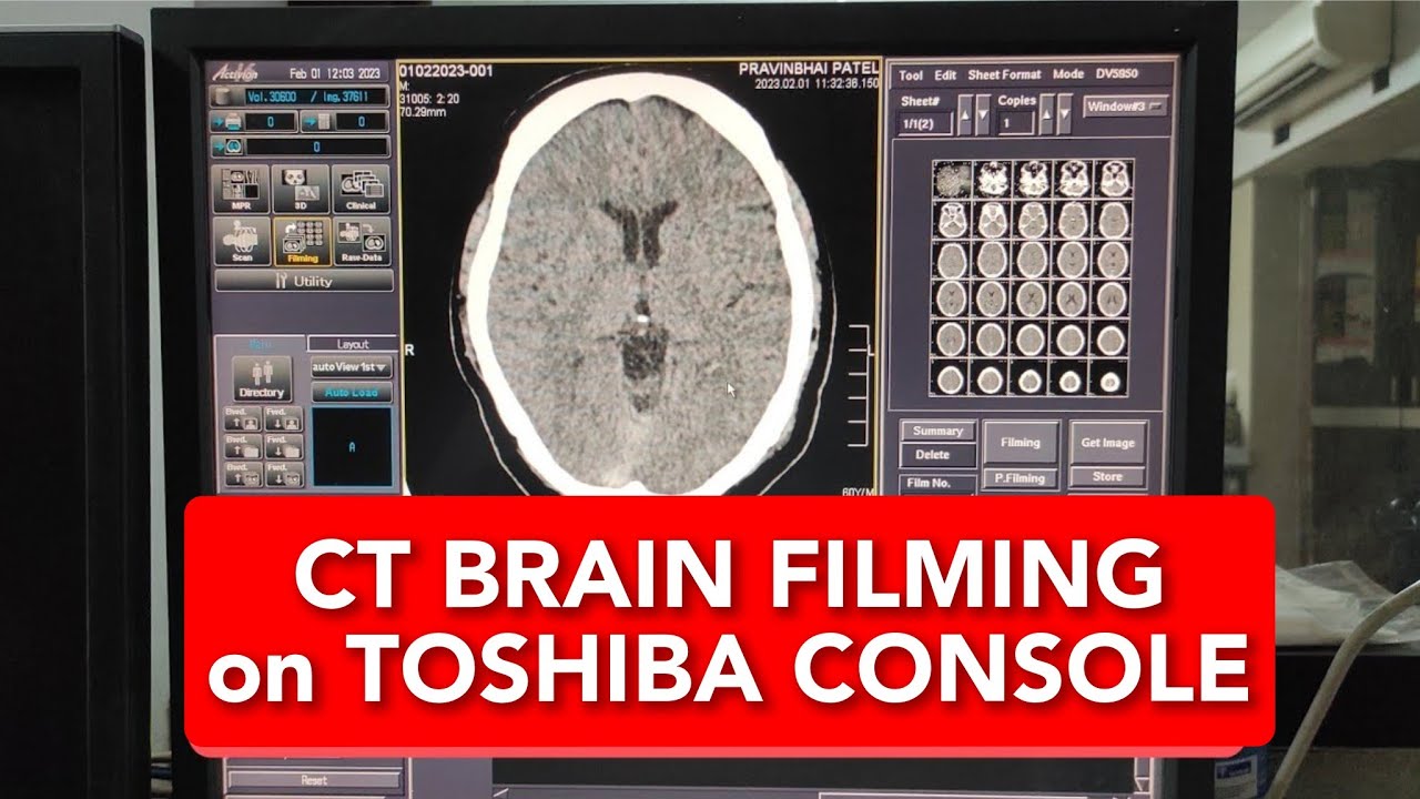 Протокол съемки КТ головного мозга на консоли Toshiba 16 Slice на английском языке.