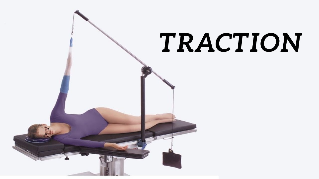 TRACTION ( Orthopedic ) Hindi