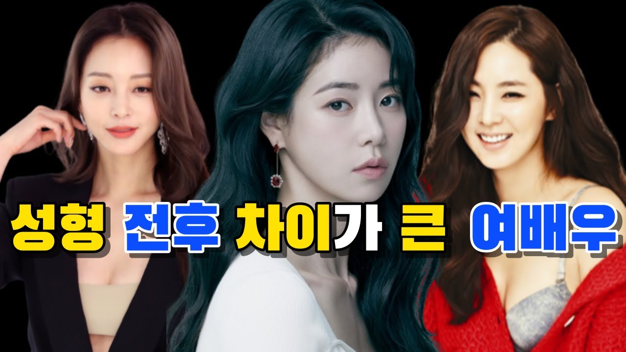 성형 전후 차이가 가장 큰 여배우 TOP 10