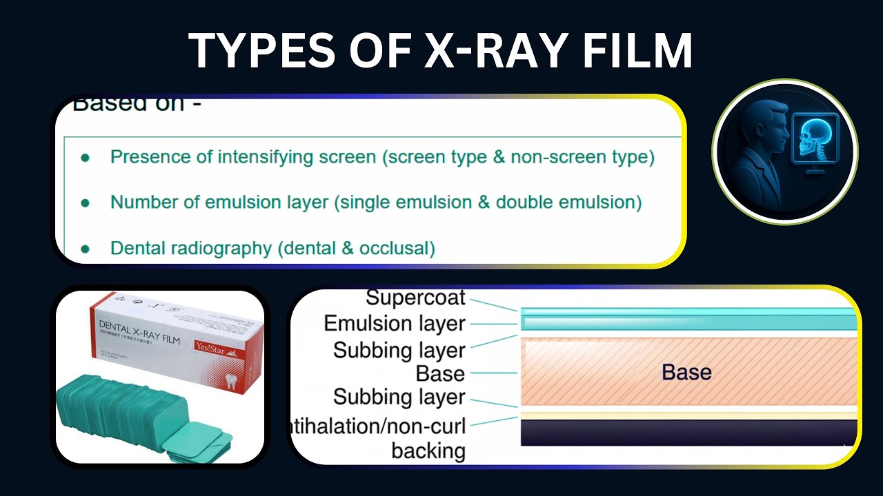 TYPES OF X RAY FILM | SCREEN TYPE & NON-SCREEN TYPE #xray #radiology #radiographer_exam