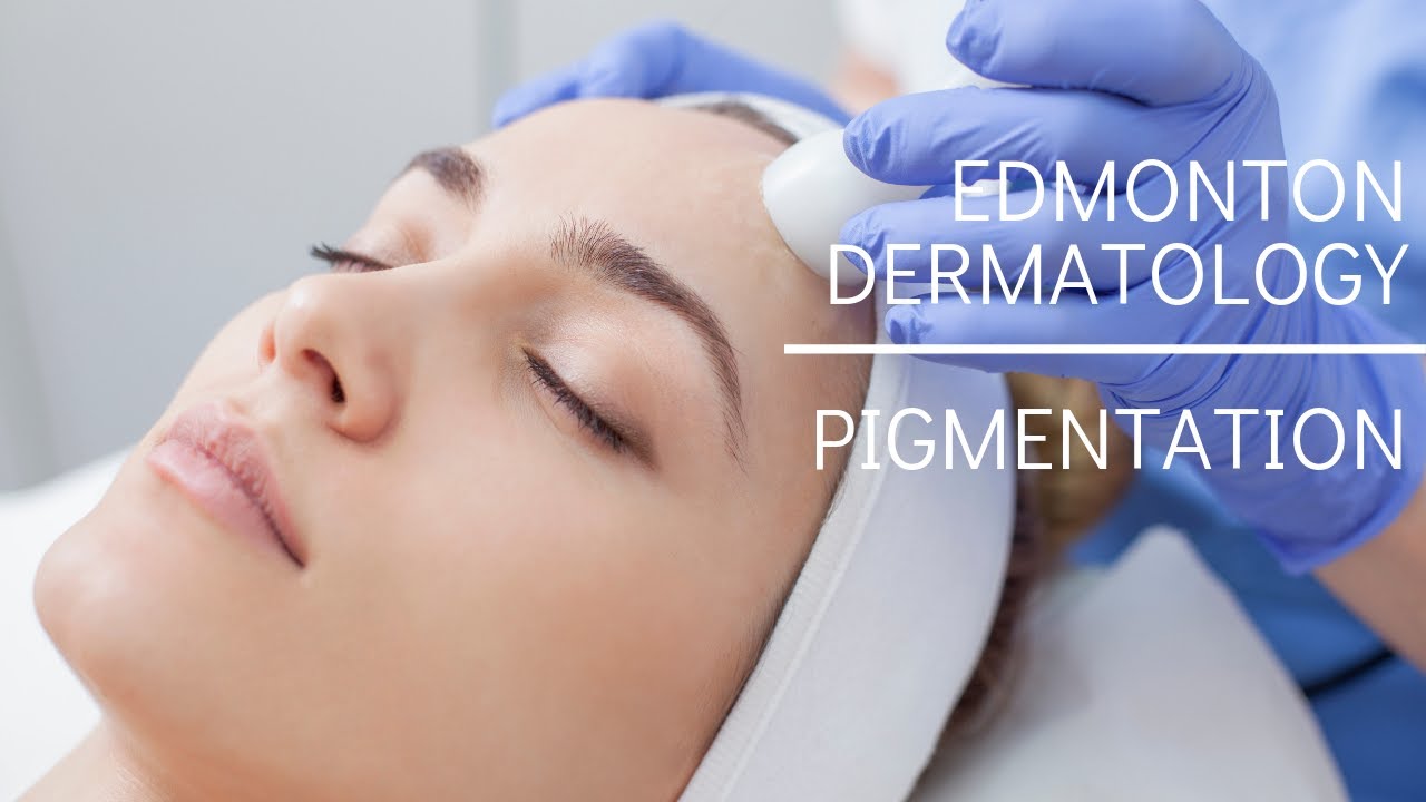 Edmonton Dermatology | Pigmentation