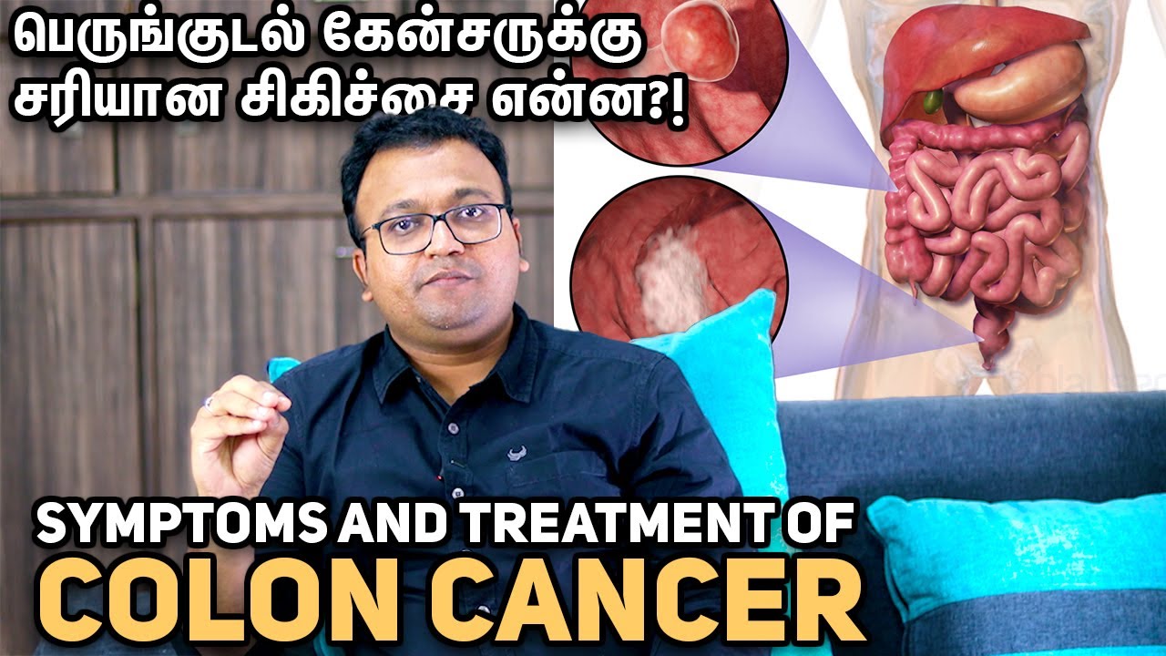 Symptoms and treatment of colon cancer| பெருங்குடல் கேன்சருக்கு சரியான சிகிச்சை என்ன?Dr. Dayananda