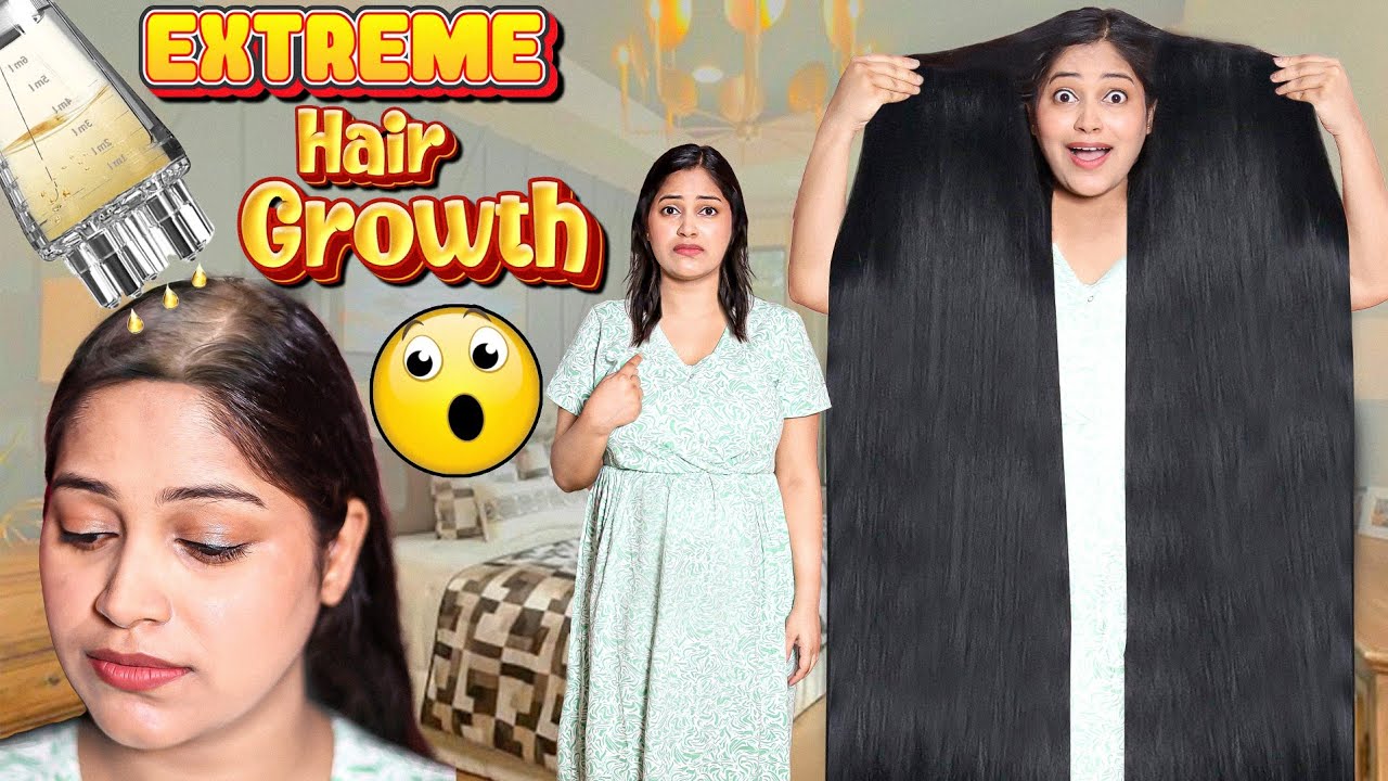 This Diy Can Grow Hair On Bald Scalp😱 गंजे सर पर बाल उगाने का असरदार नुस्खा Rs 0 खर्चा 3X Hairgrowth