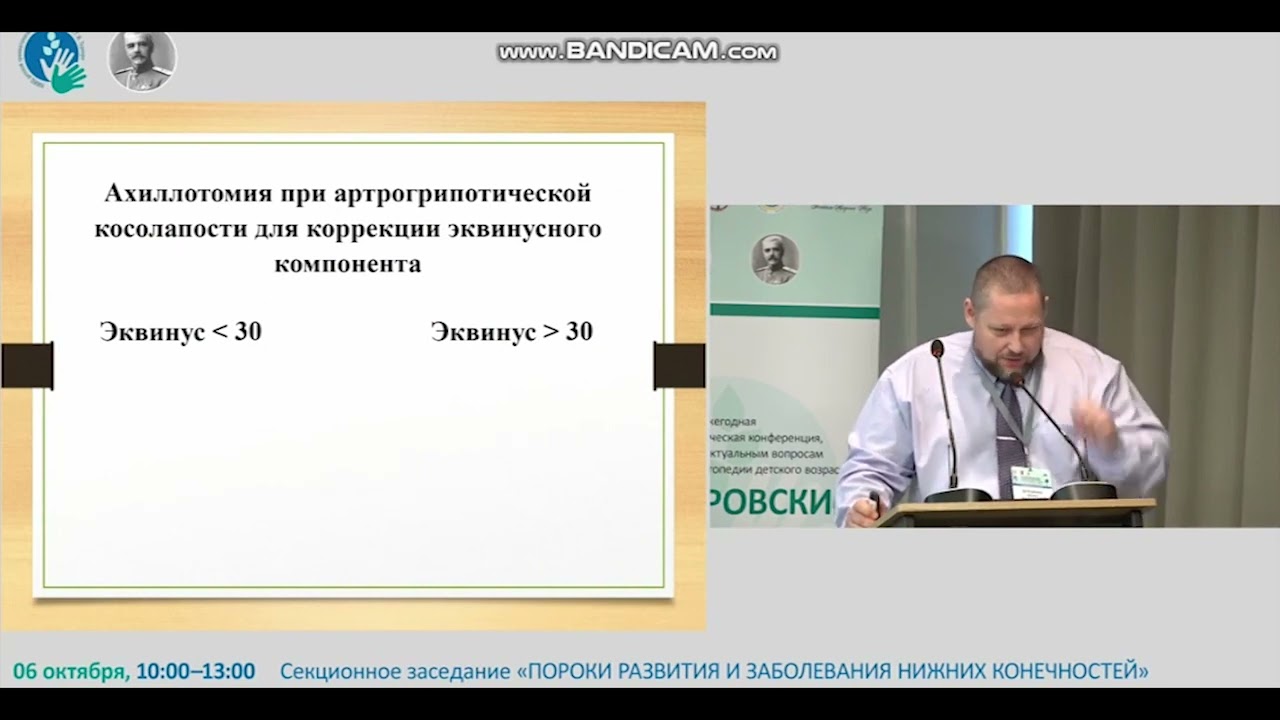 Частные вопросы лечения косолапости по методу Понсети. Готовы ли мы к неожиданностям?