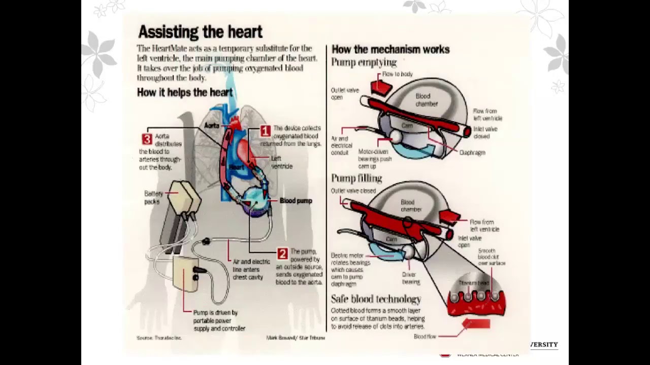 Can We Cure Dilated Cardiomyopathy? by Dr  Binkley