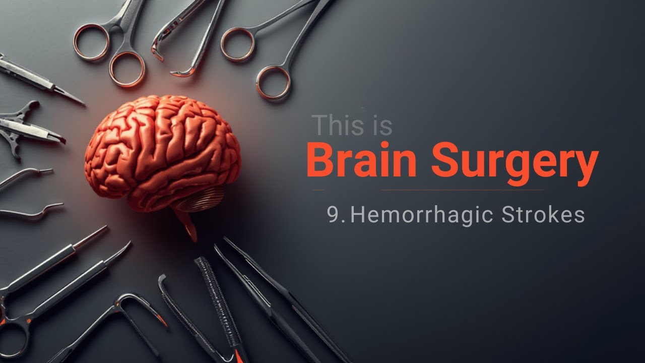 This is Brain Surgery 9: Hemorrhagic strokes