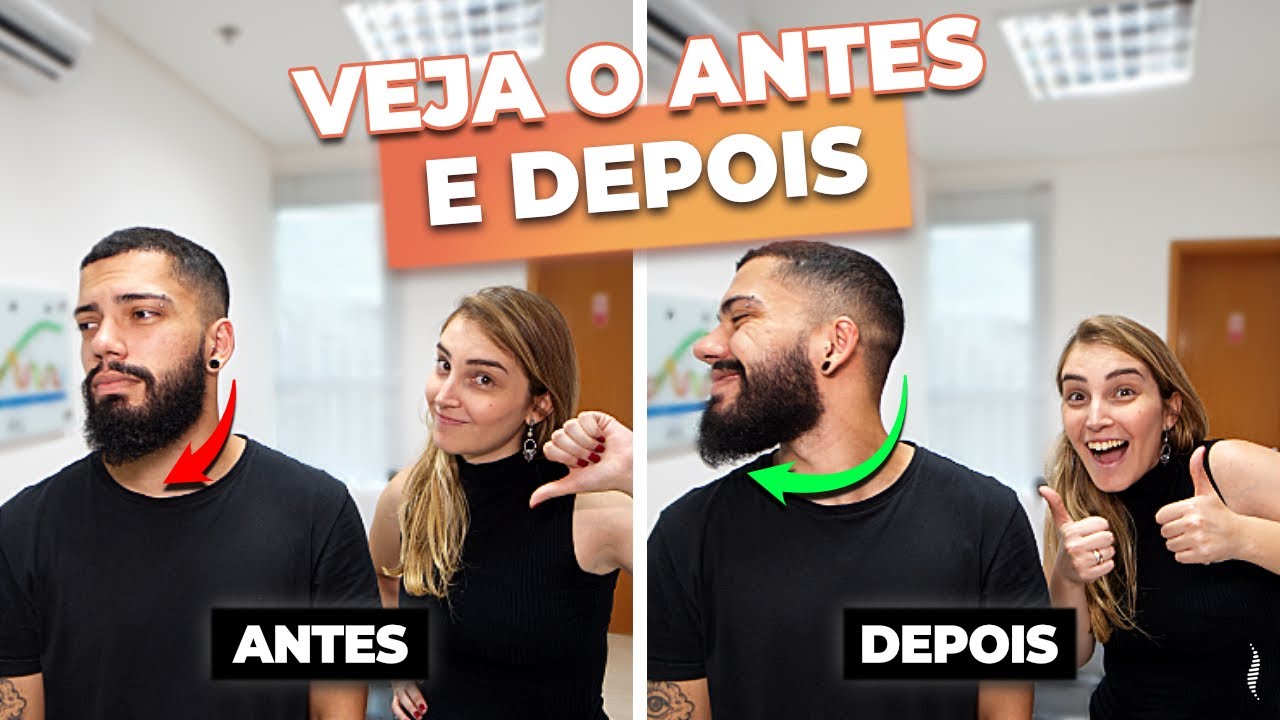 PODE FAZER QUIROPRAXIA COM TORCICOLO FORTE?