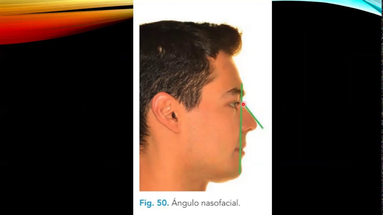 IPE ANALISIS DE POWELL DR JONATHAN BERMUDEZ