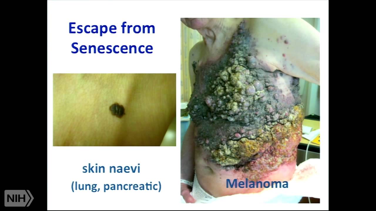 Epigenetic Regulation of Senescence and Aging