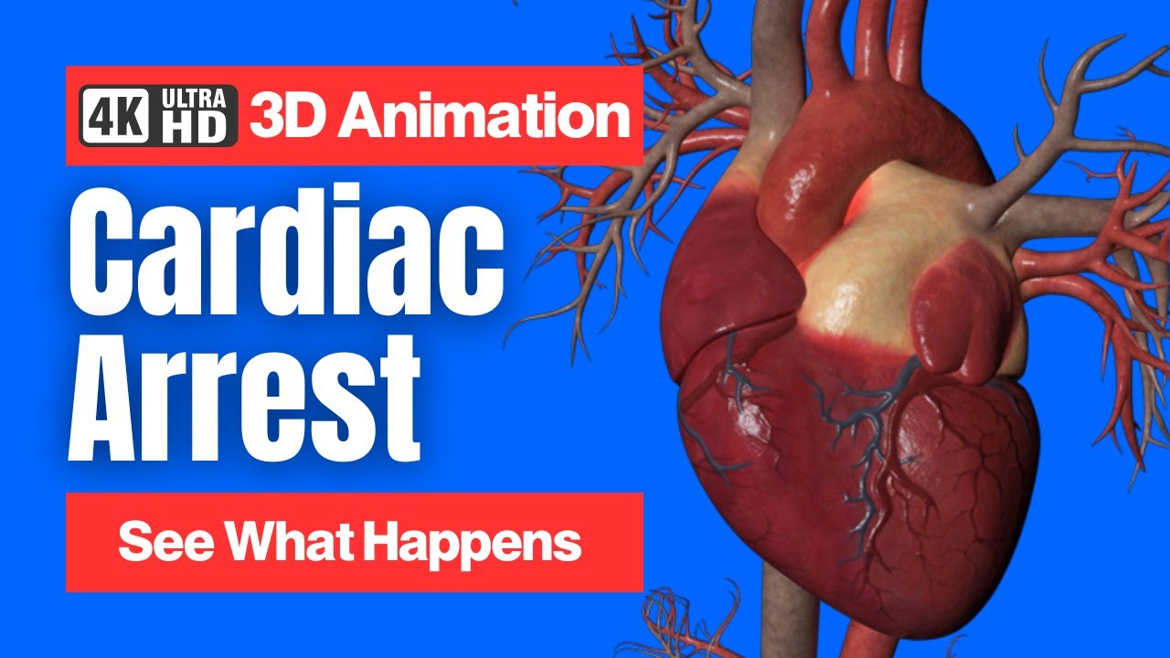 Cardiac Arrest - See What Happens - 4K 3D Animation