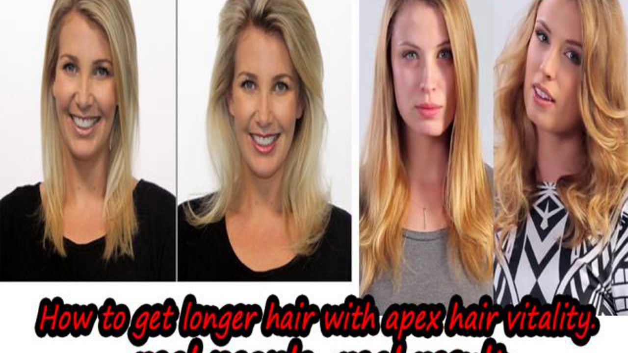 Hair fall in men