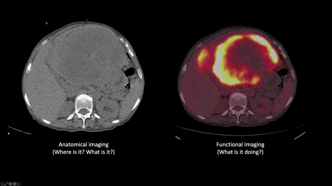 Nuclear medicine physics and applications