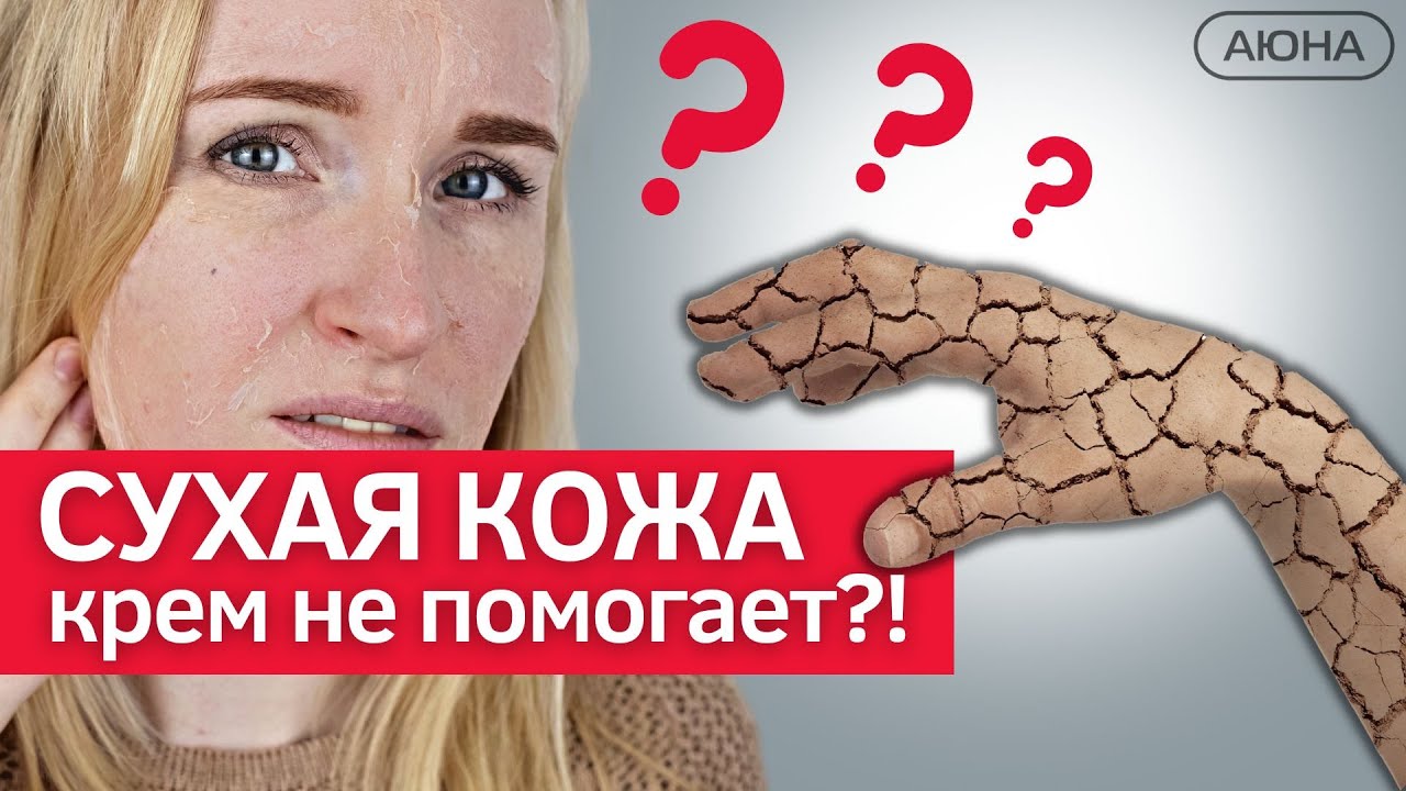 ОЧЕНЬ СУХАЯ КОЖА. Как выбрать КРЕМ? Как убрать сухость и шелушение кожи