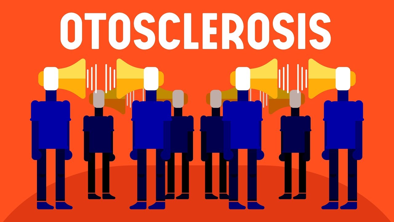 What is Otosclerosis?