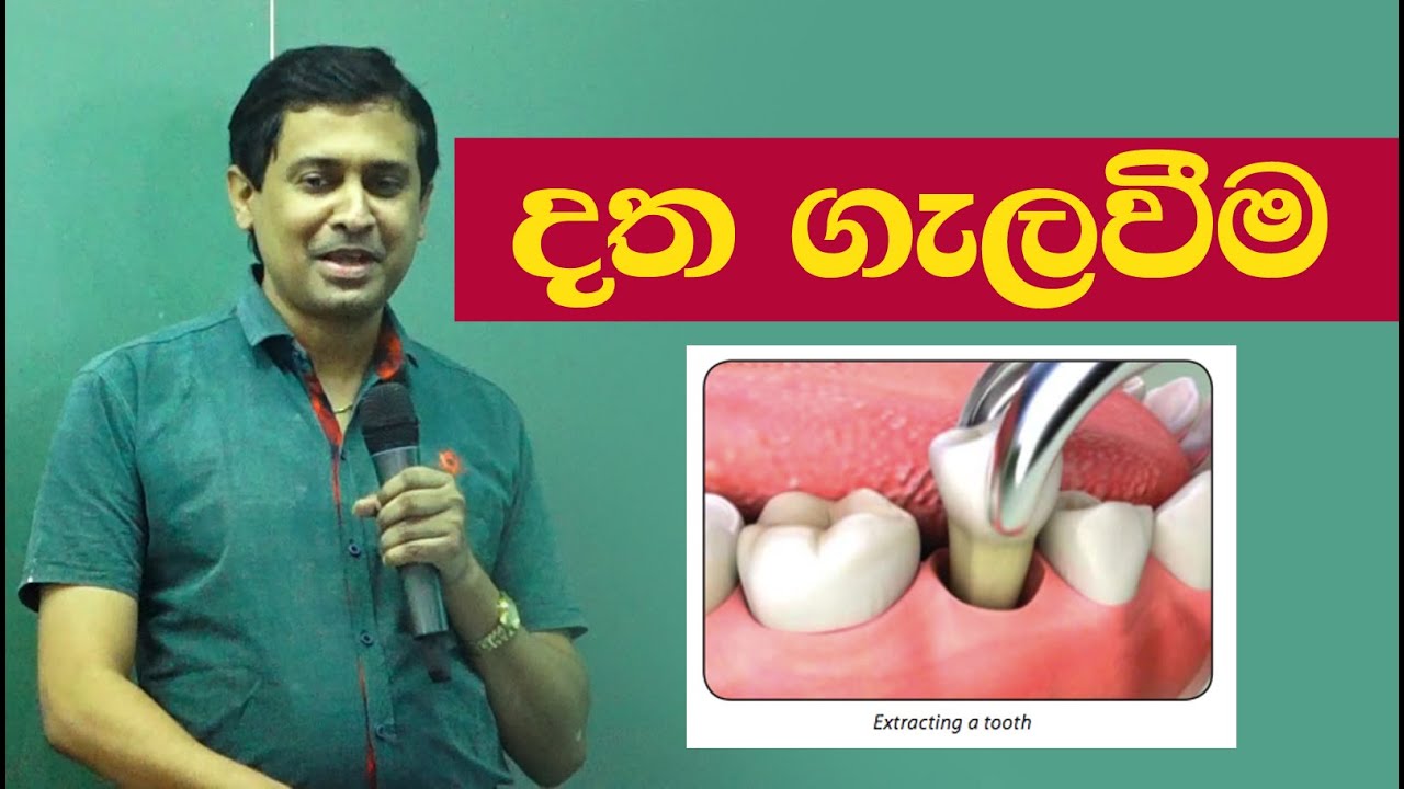 Tissa Jananayake - Episode 19 | Tooth Extracting | දත ගැලවීම
