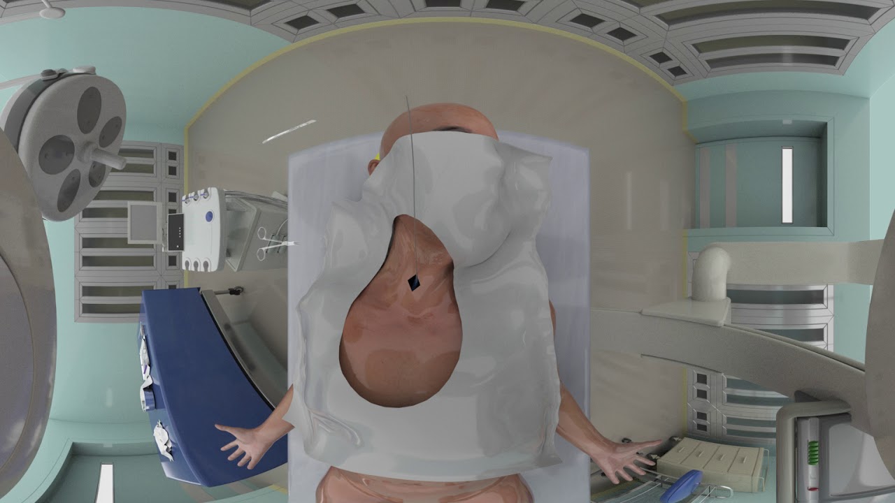 케모포트 삽입 VR (Chemoport Insertion) [마삼티]