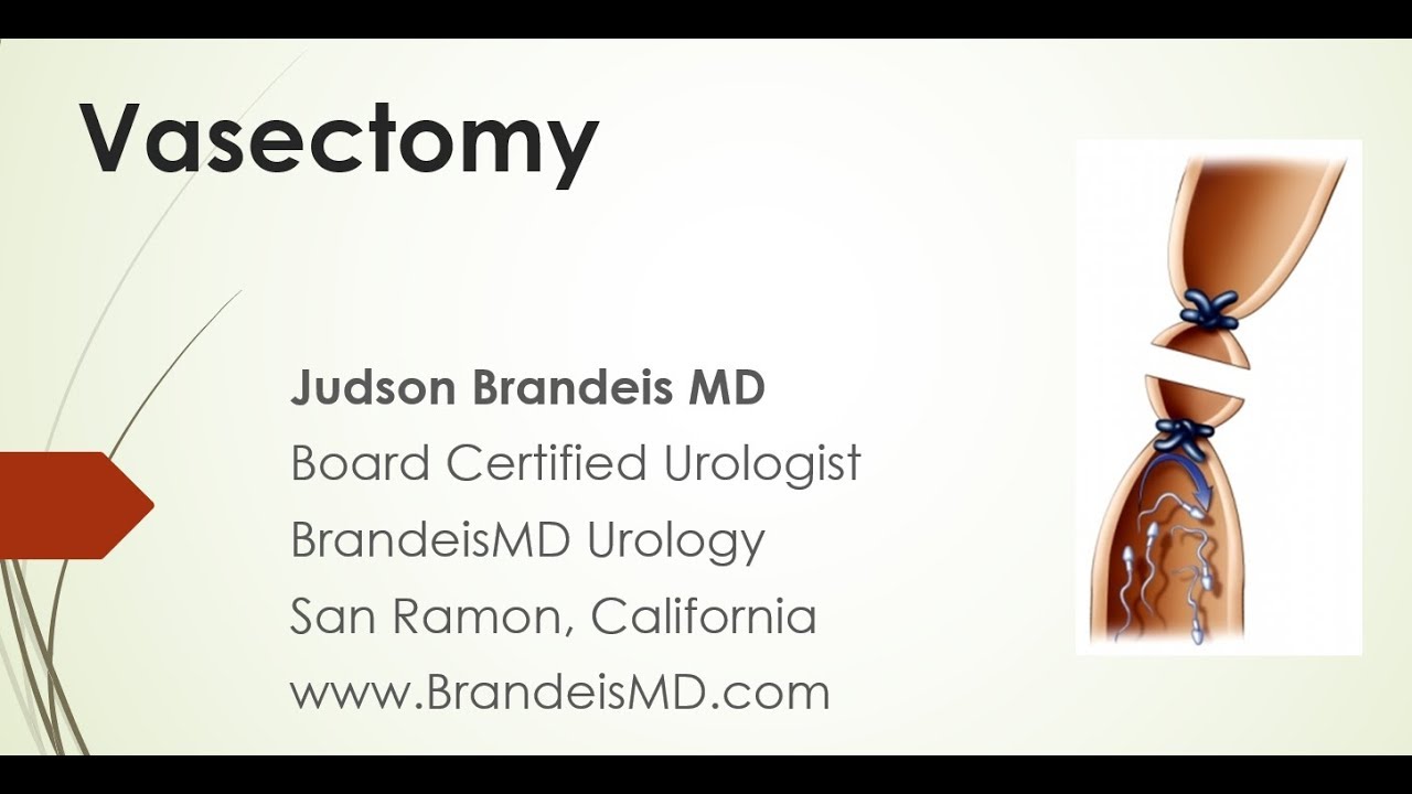 No Scalpel Vasectomy