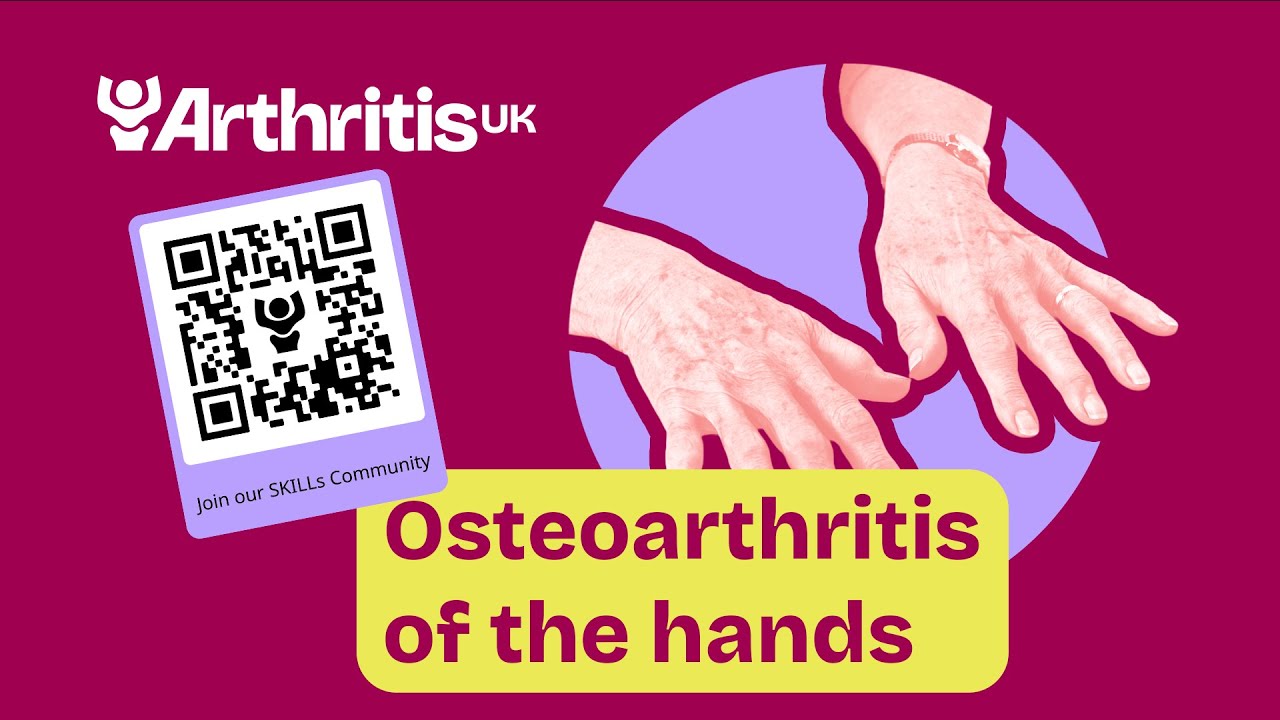 Osteoarthritis of the hands