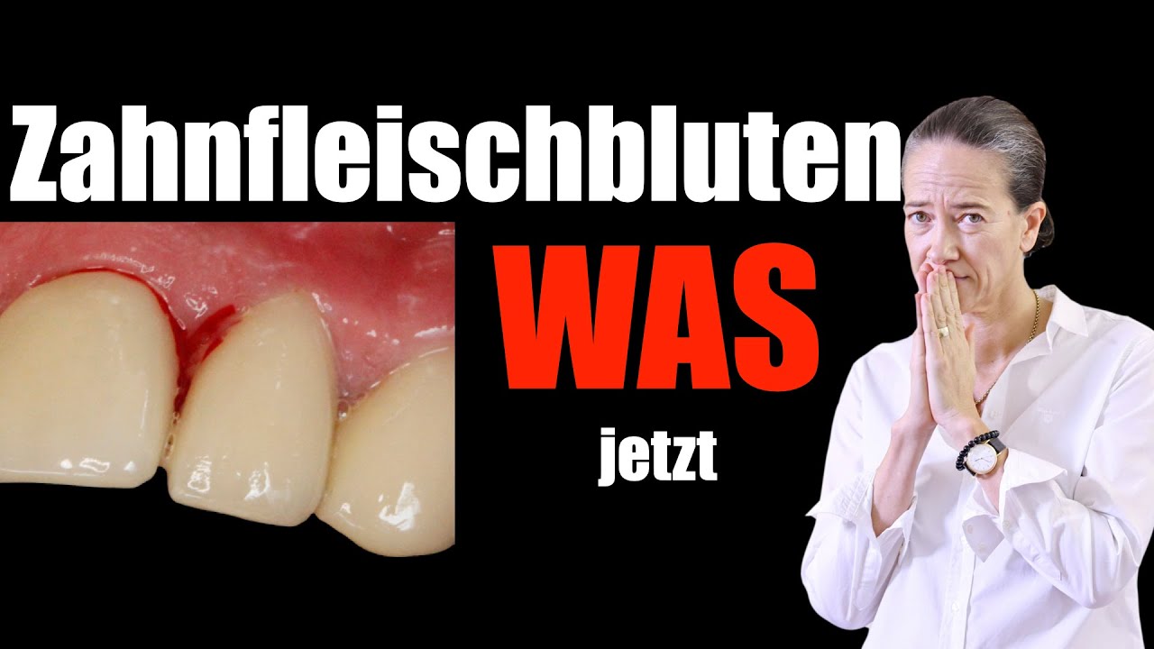 Zahnfleisch BLUTET: deine GEFAHR