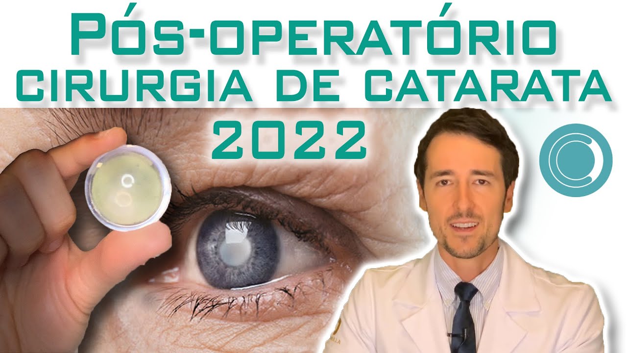 Pós-operatório de catarata - como ter uma boa recuperação.
