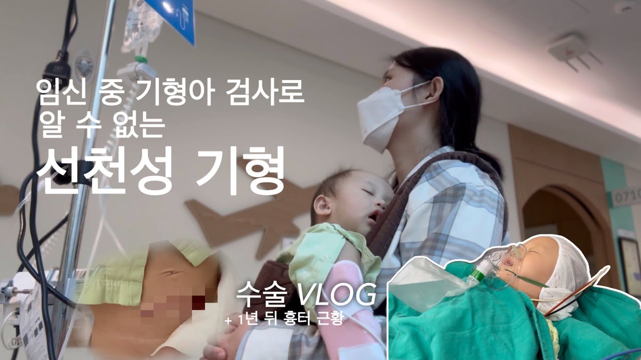 선천성 기형 검사부터 수술 과정 아기 방광 요관 역류 VLOG