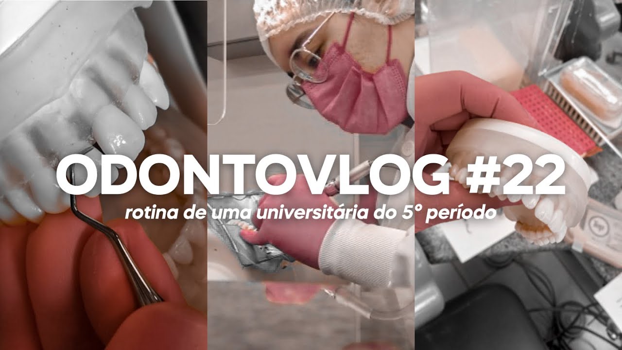 ODONTOVLOG #22: uma semana pr&aacute;tica comigo | Odonto Energy