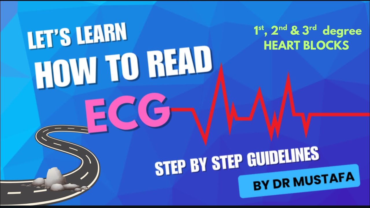 How to read ECG? - Part 2 l HEART BLOCKS explained for junior doctors 