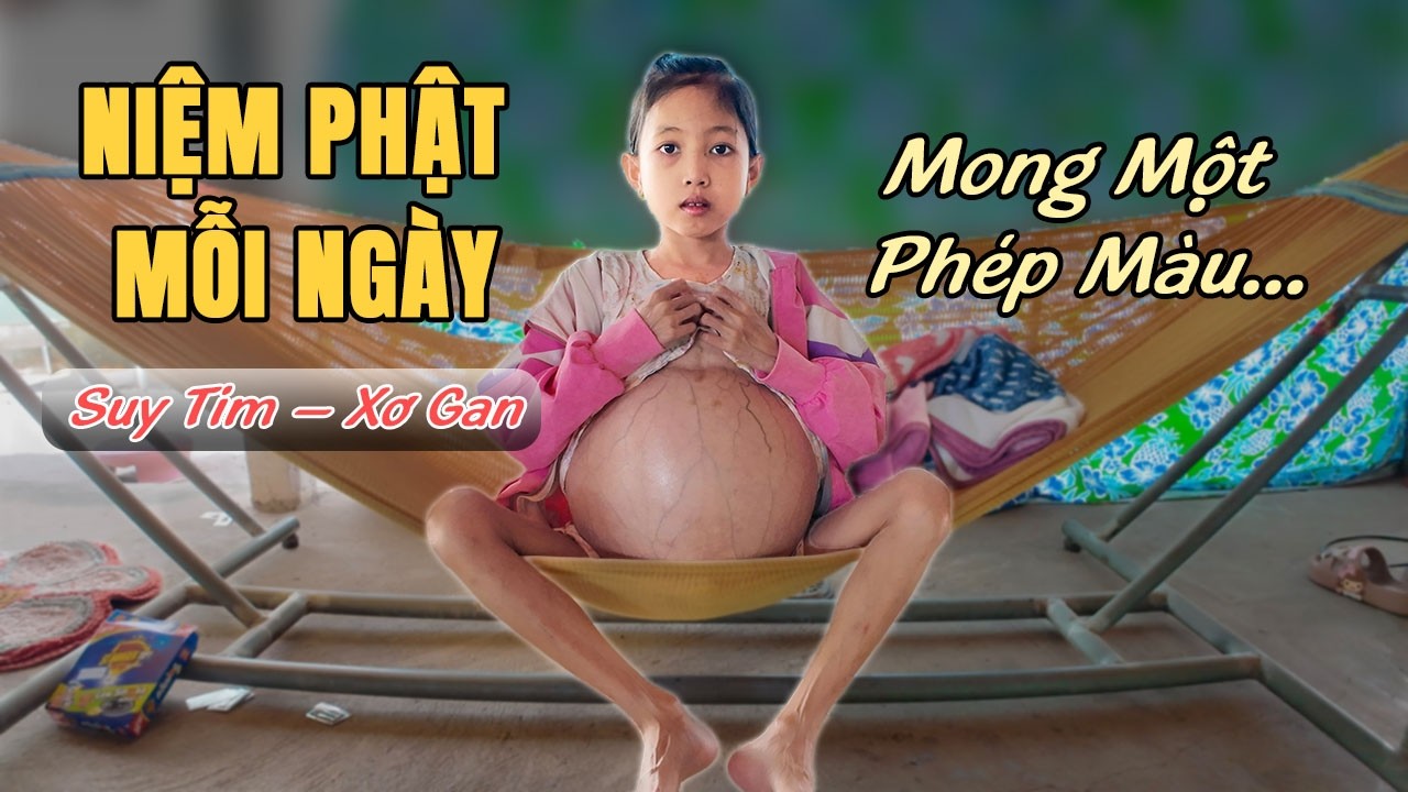 559. Bé Gái Suy Tim, Xơ Gan – Mỗi Ngày Trôi Qua Là Một Cuộc Chiến