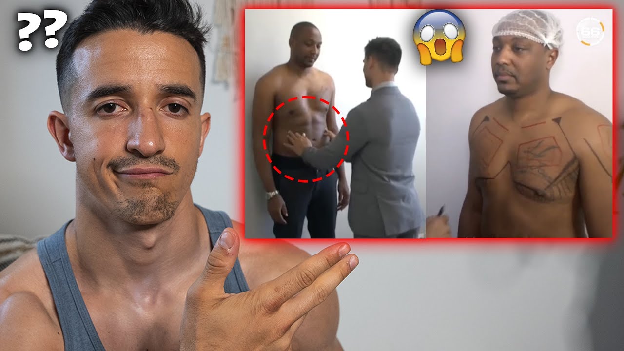 IL FAIT DE LA CHIRURGIE POUR ÊTRE MUSCLÉ !!