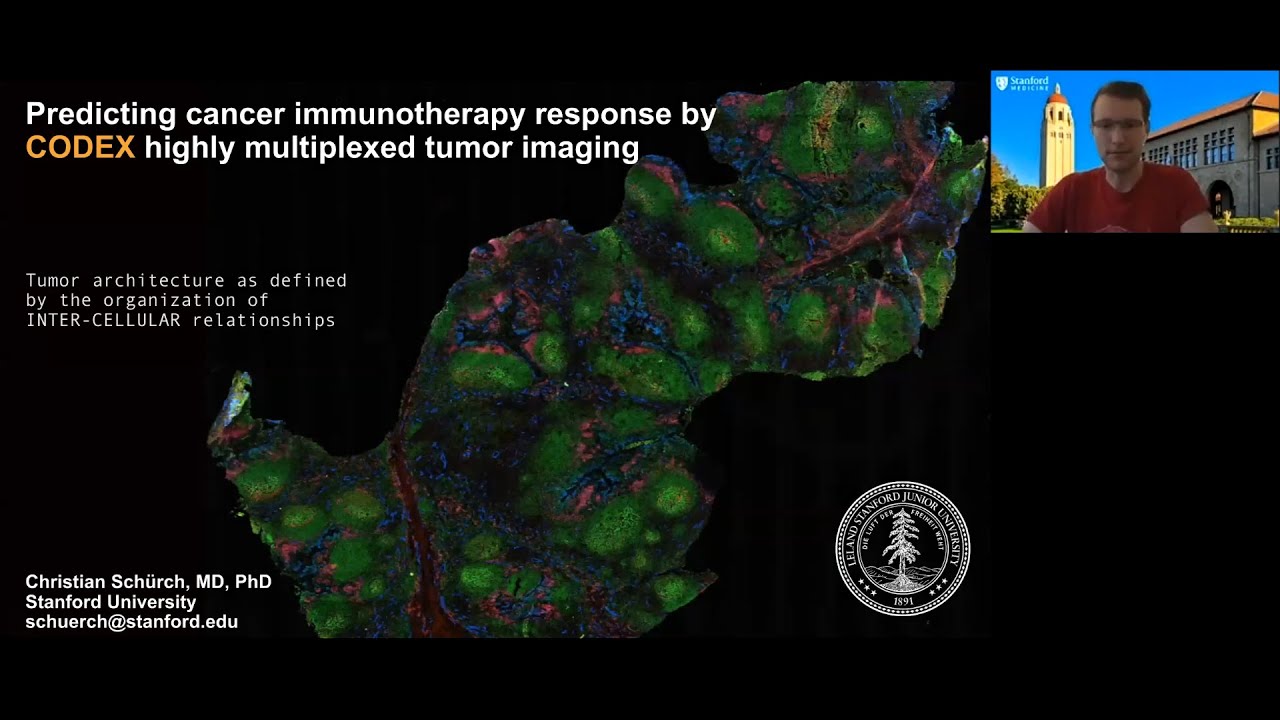 Predicting cancer immunotherapy response by CODEX highly multiplexed tumor imaging