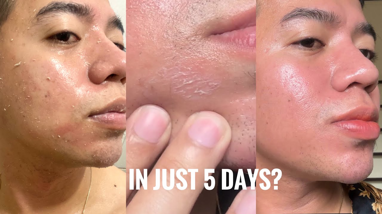 Fairy Skin Premium Brightening Kit | 5-day Results 2023