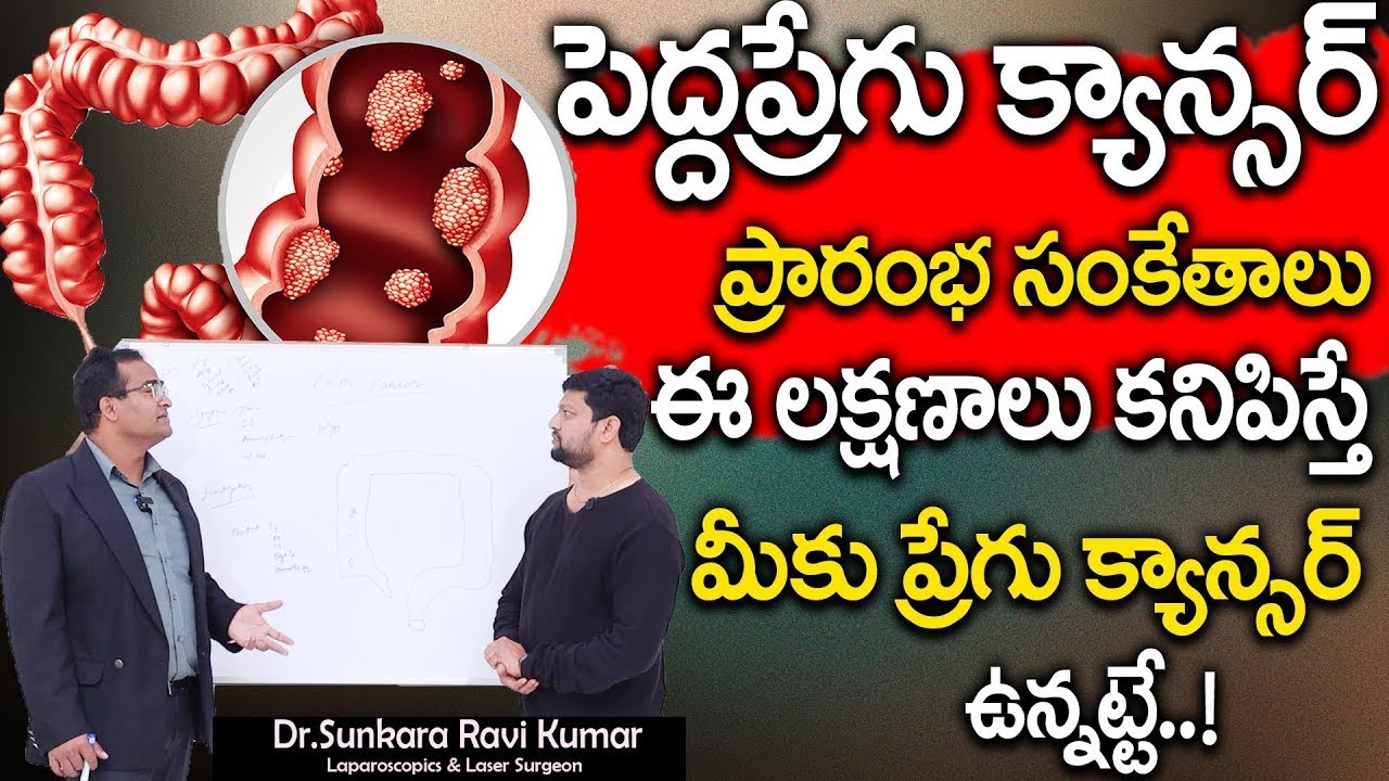 Colon Cancer Symptoms in Telugu | Dr. Sunkara Ravi Kumar | పెద్ద పేగు కాన్సర్ లక్షణాలు | Sumantv