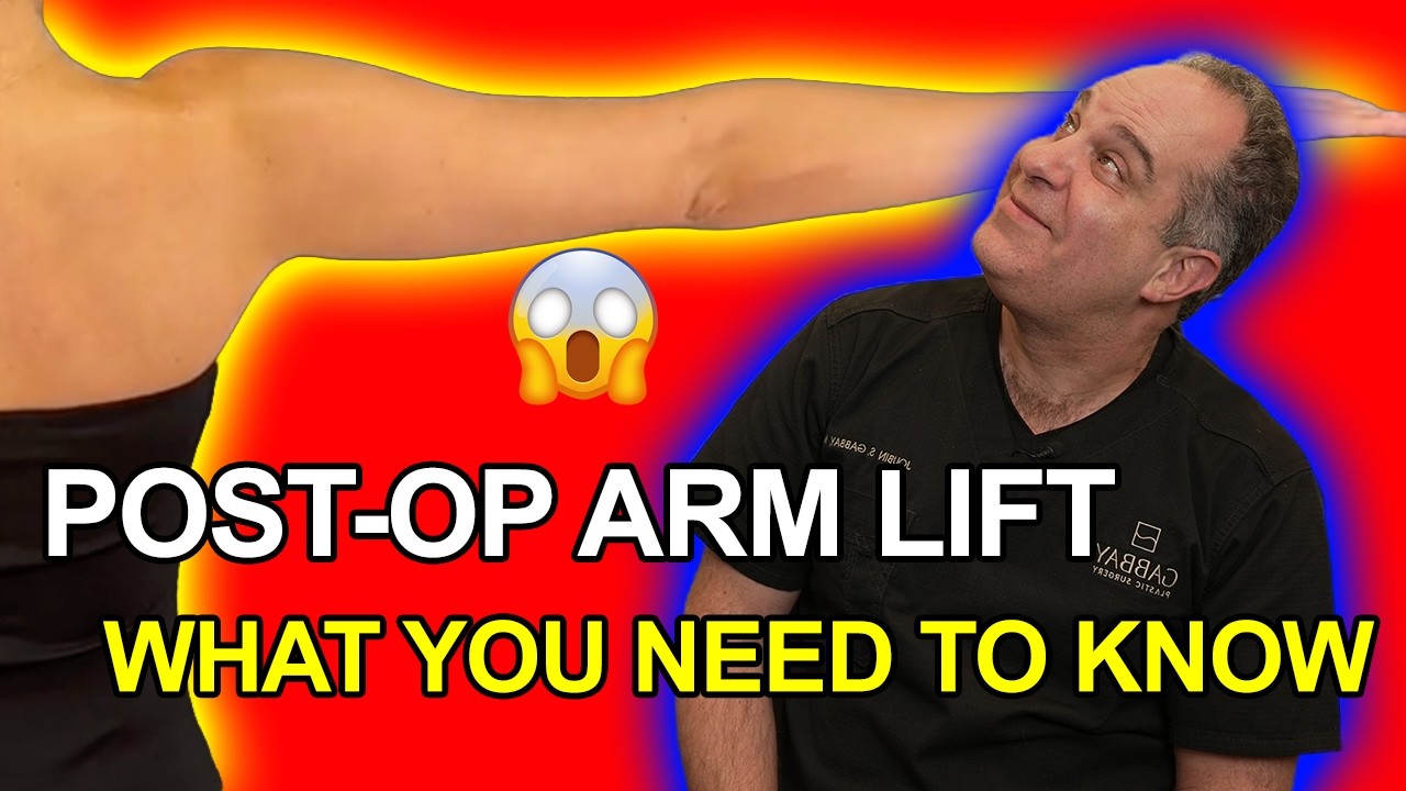 Arm Lift Surgery Recovery | What You Should Know After Your Arm Lift