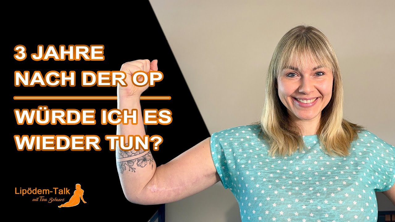 Lipödem an den Armen - Vorher-Nachher nach Liposuktion und Hautstraffung