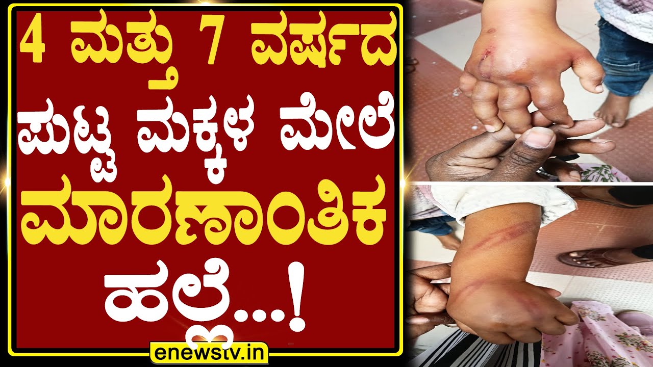 ೪ ಮತ್ತು ೭ ವರ್ಷದ ಪುಟ್ಟ ಮಕ್ಕಳ ಮೇಲೆ ಮಾರಣಾಂತಿಕ ಹಲ್ಲೆ...! ENEWS TV
