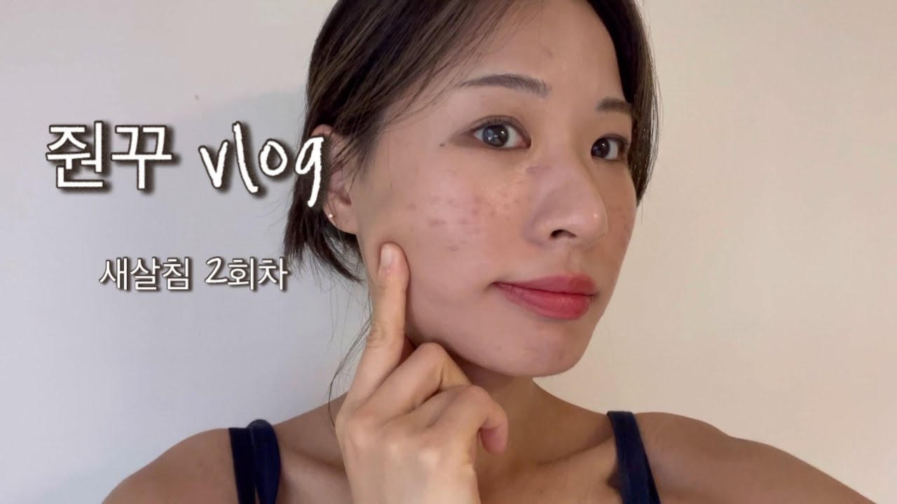 [새살침 치료 Vlog] 새살침 2회차 후기/2주간의 일상/ 마라수혈/ 인생 첫 탈색/ 발레아쥬 염색/ 오개월 만에 본가/ 언니 생일/ 드디어 먹어본 요아정