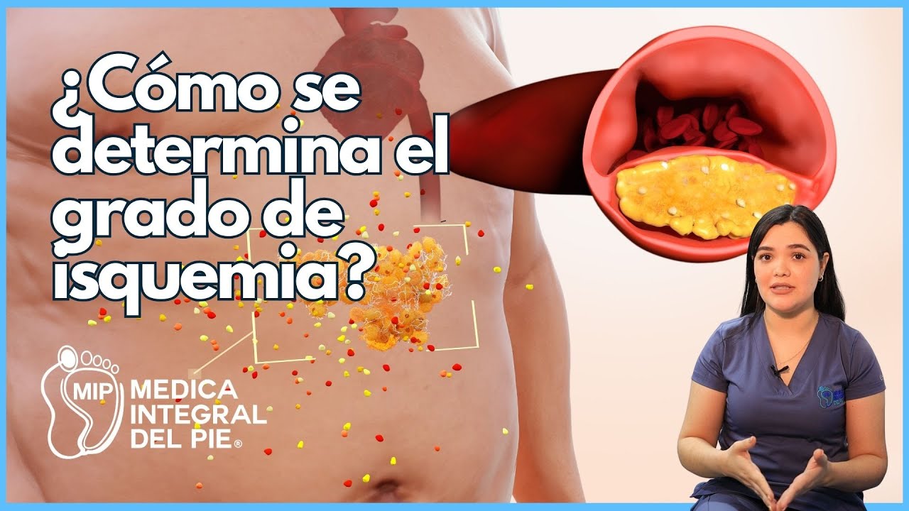 ISQUEMIA: S&iacute;ntomas, Tratamiento y qu&eacute; es