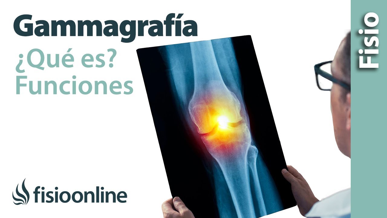 Gammagrafía - ¿Qué es y cómo funciona?