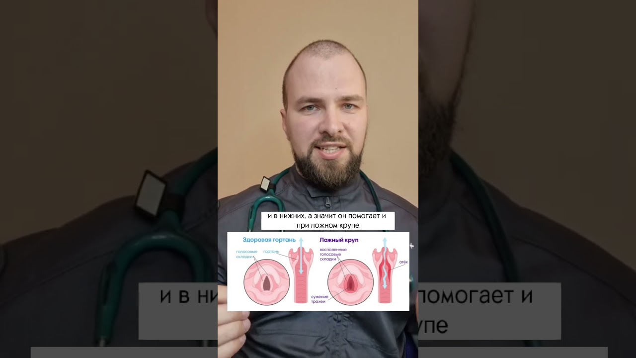 Что лучше: Пульмикорт или Беродуал?