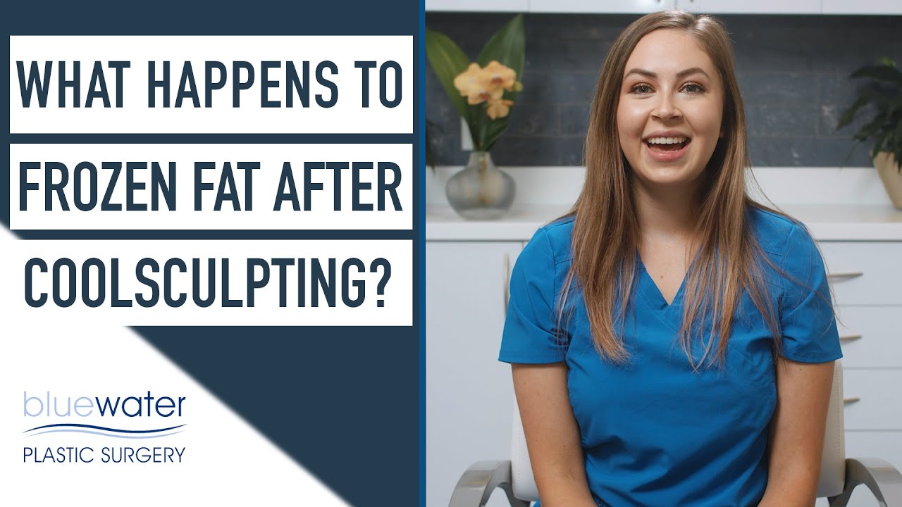 What Happens to Frozen Fat After CoolSculpting? | Blue Water Spa | CoolSculpting Results Durham NC